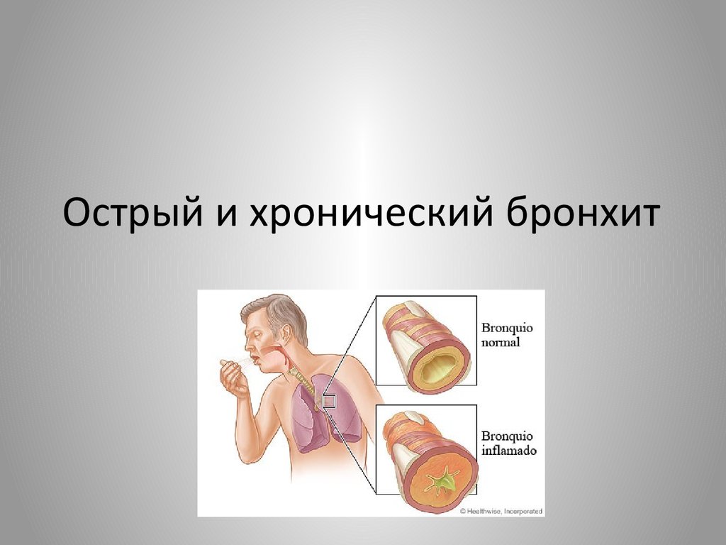 Бронхит презентация по биологии