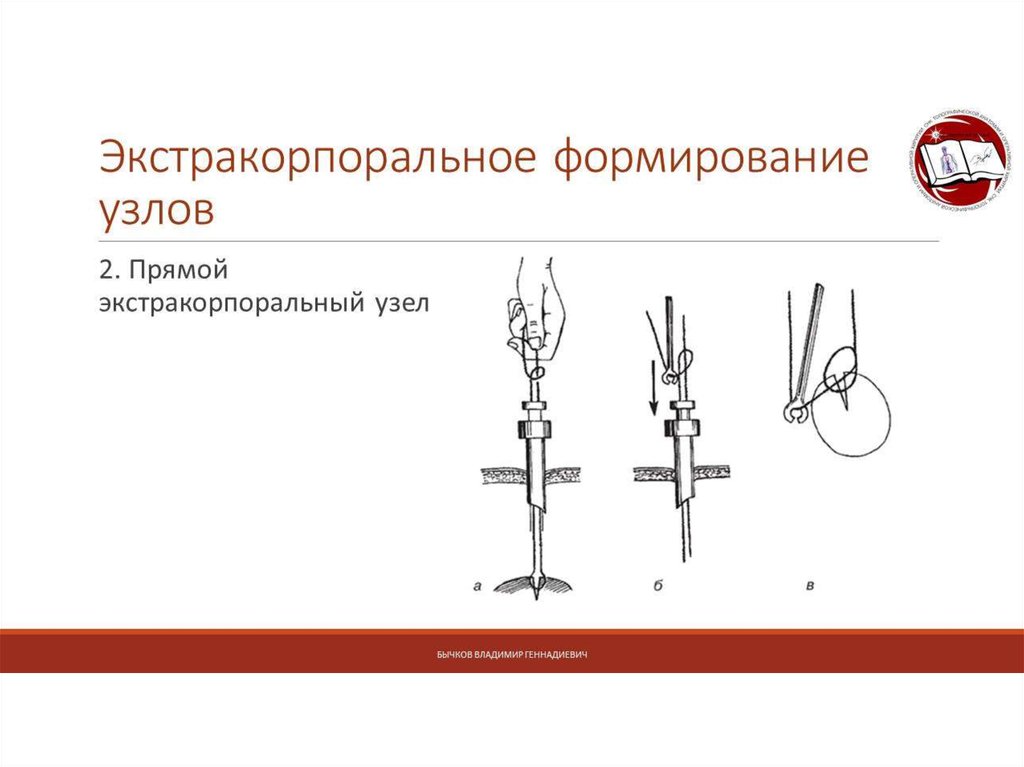 Формирование узлов. Экстракорпоральный узел. Экстракорпоральный шов. Узел для экстракорпорального. Экстракорпоральное формирование узлов.