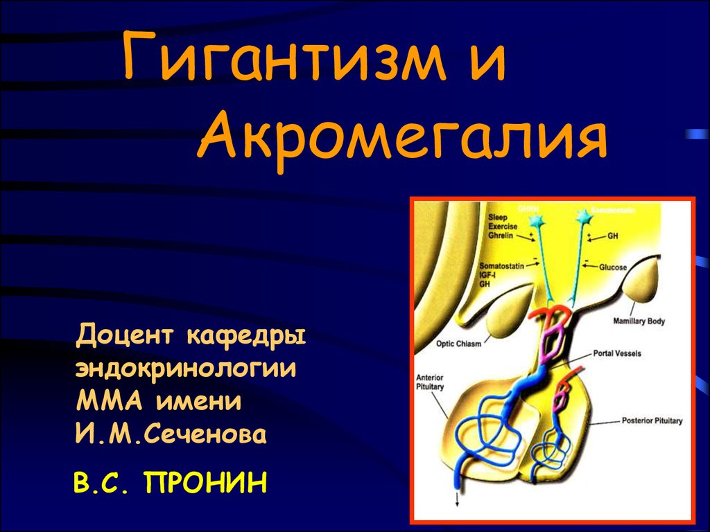 Акромегалия и гигантизм презентация