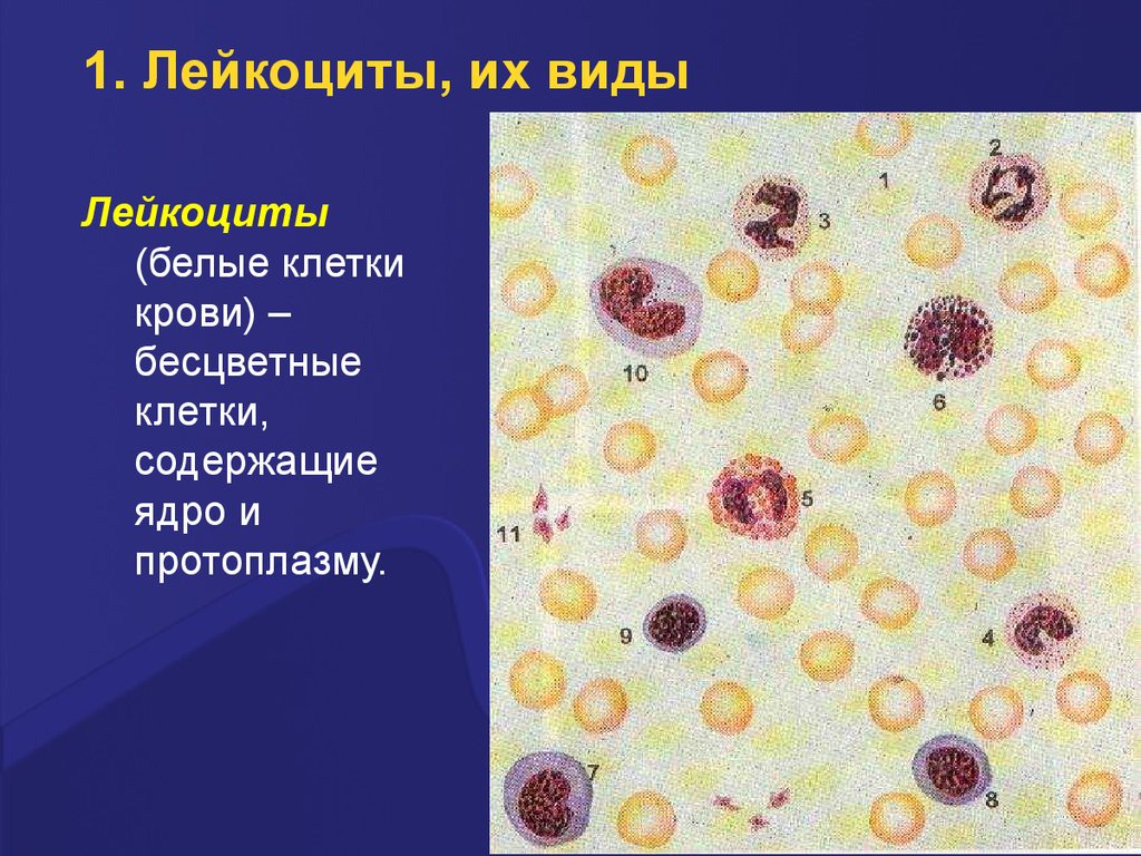Лейкоциты 3 3 у мужчин. Бесцветные клетки крови. Разновидности лейкоцитов. Ядро лейкоцитов разновидности. Лейкоциты содержат ядро.