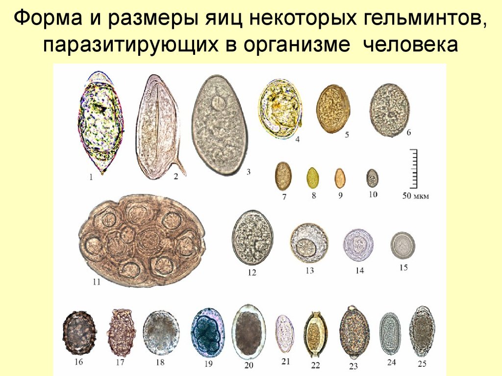 Яйца глистов. Яйца гельминтов паразитов человека. Атлас определитель яиц гельминтов. Яйца гельминтов микроскопия.