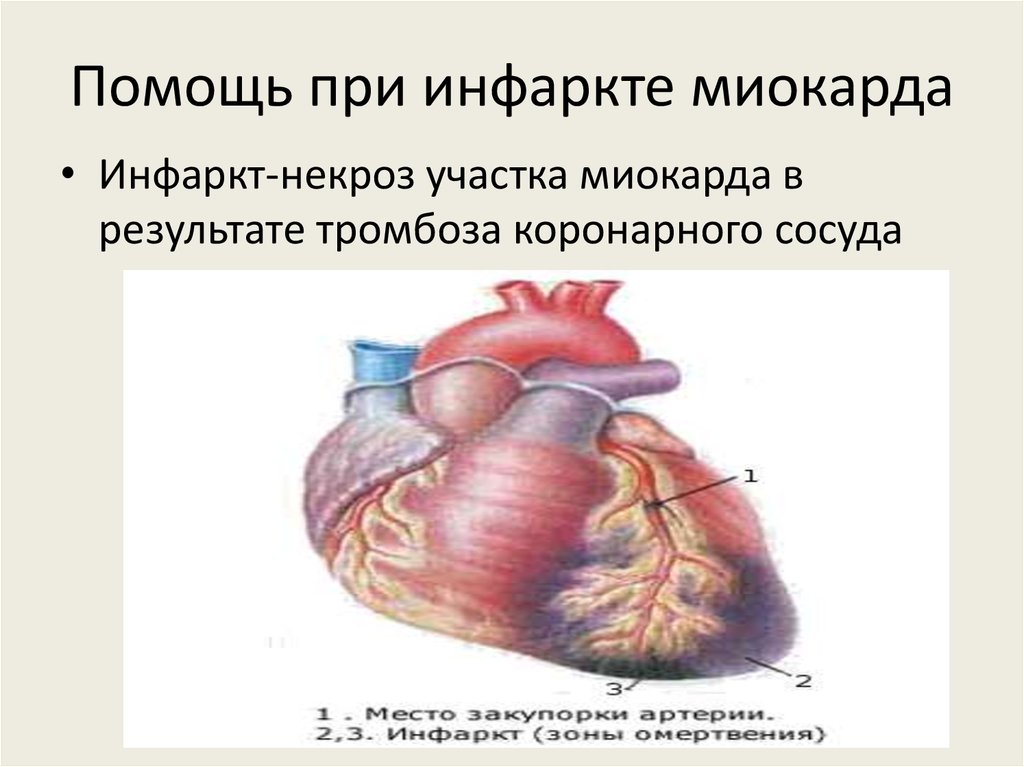 Средства влияющие на сердечно сосудистую систему презентация