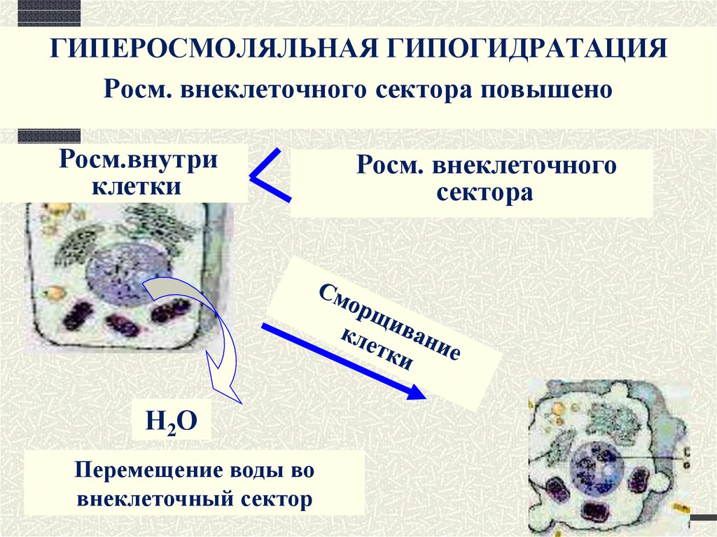 Гипогидратация. Перемещение воды из клетки. Клетки и внеклеточные структуры включения. Электролиты клетки.