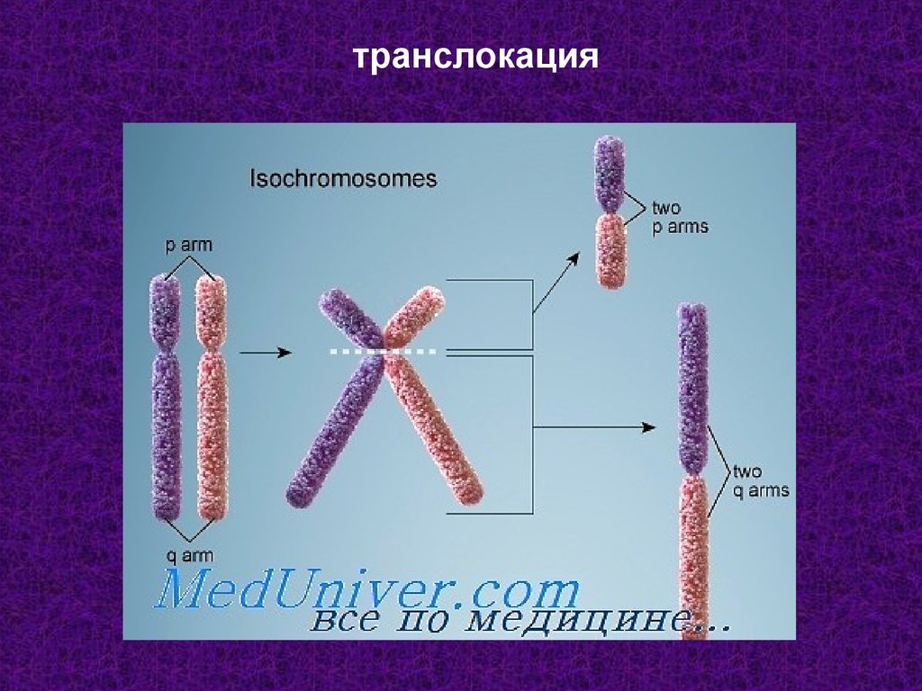 Транслокация хромосом фото