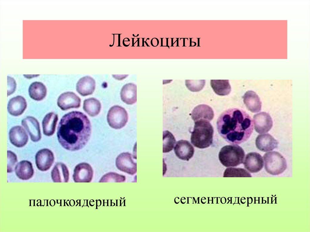 Сегмента ядерная. Палочкоядерные и сегментоядерные лейкоциты. Палочкоядерный и сегментоядерный нейтрофил. Палочкоядерные нейтрофилы цитоплазма. Нейтрофильный сегментоядерный лейкоцит.
