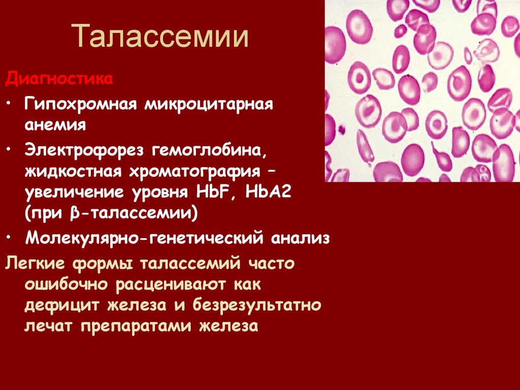 Переливание крови при каком гемоглобине. Талассемия форма эритроцитов. Талассемия характеристика анемии. Талассемия гипохромная анемия. Болезнь крови талассемия.