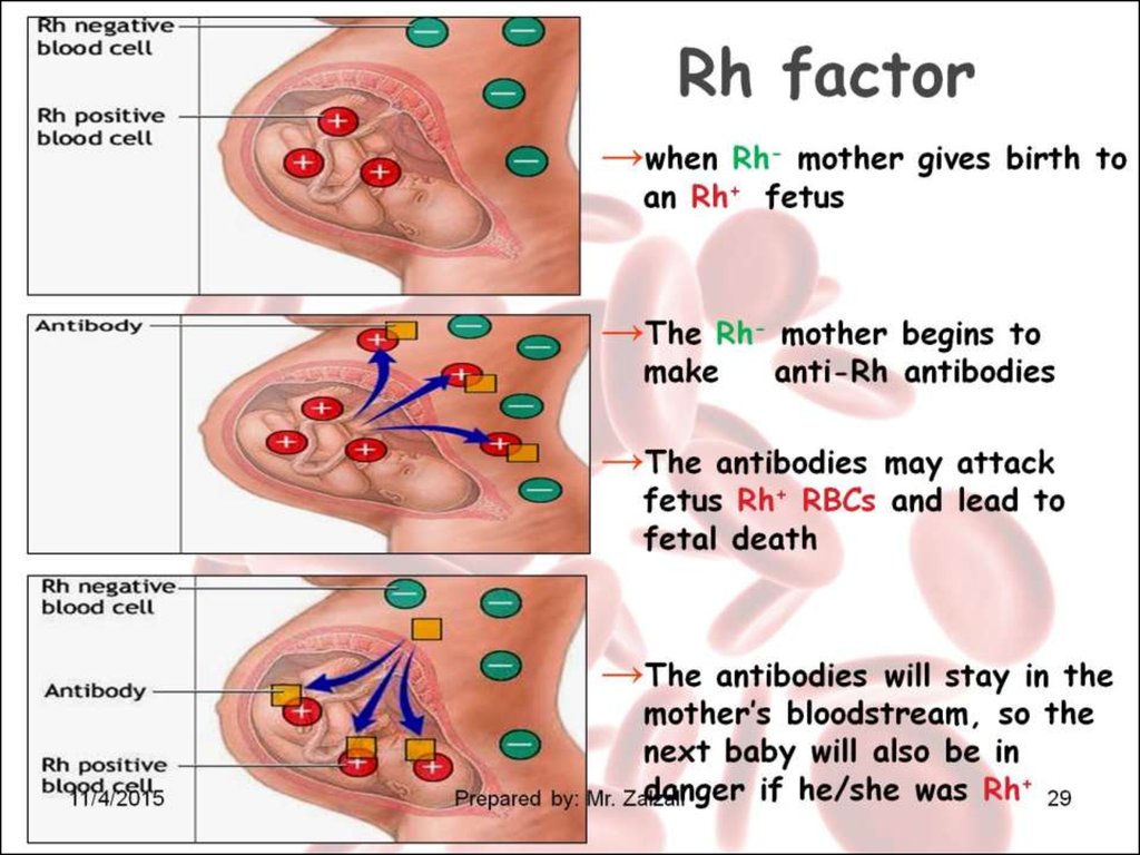 Rh factor