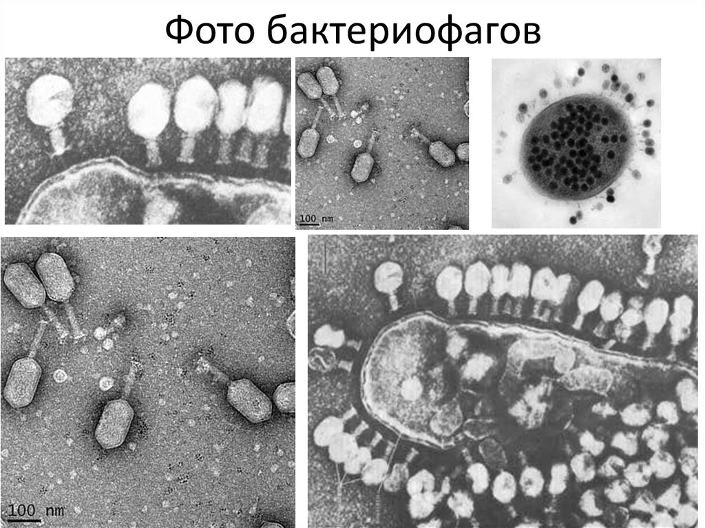 Бактериальный вирус. Кишечные бактериофаги (колифаги). Бактериофаг микрофотография. Бактериофаг под микроскопом. Бактериофаги вирусы поражающие бактерии.