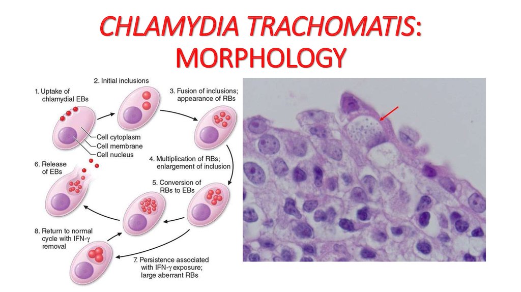 Chlamydia Trachomatis Gram Stain Morphology