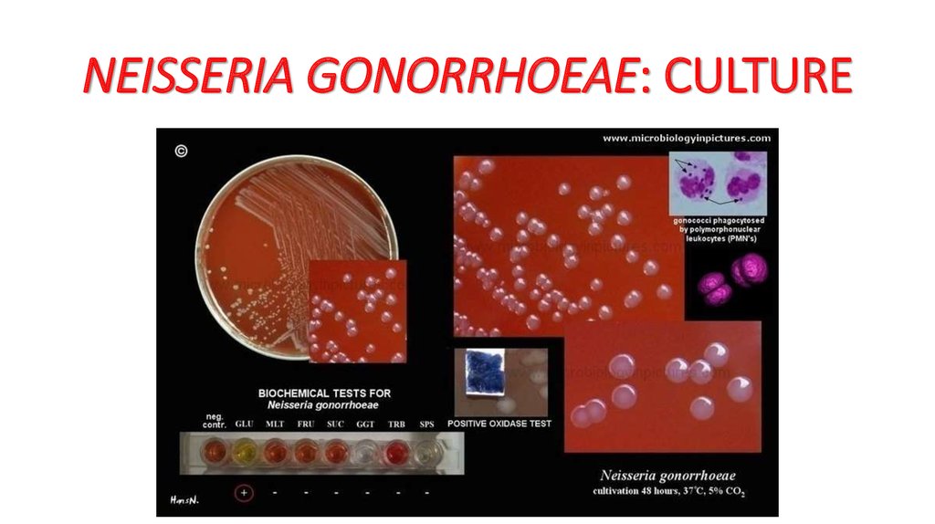 .ually transmitted bacterial diseases - online presentation