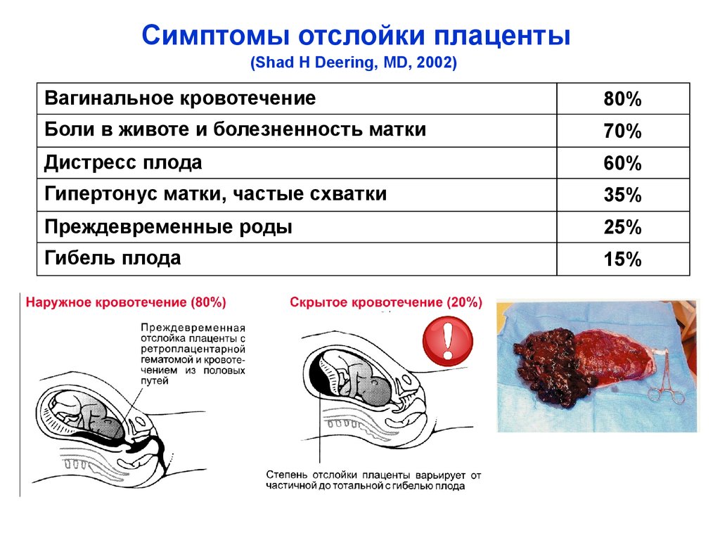 Кровотечение тянет живот