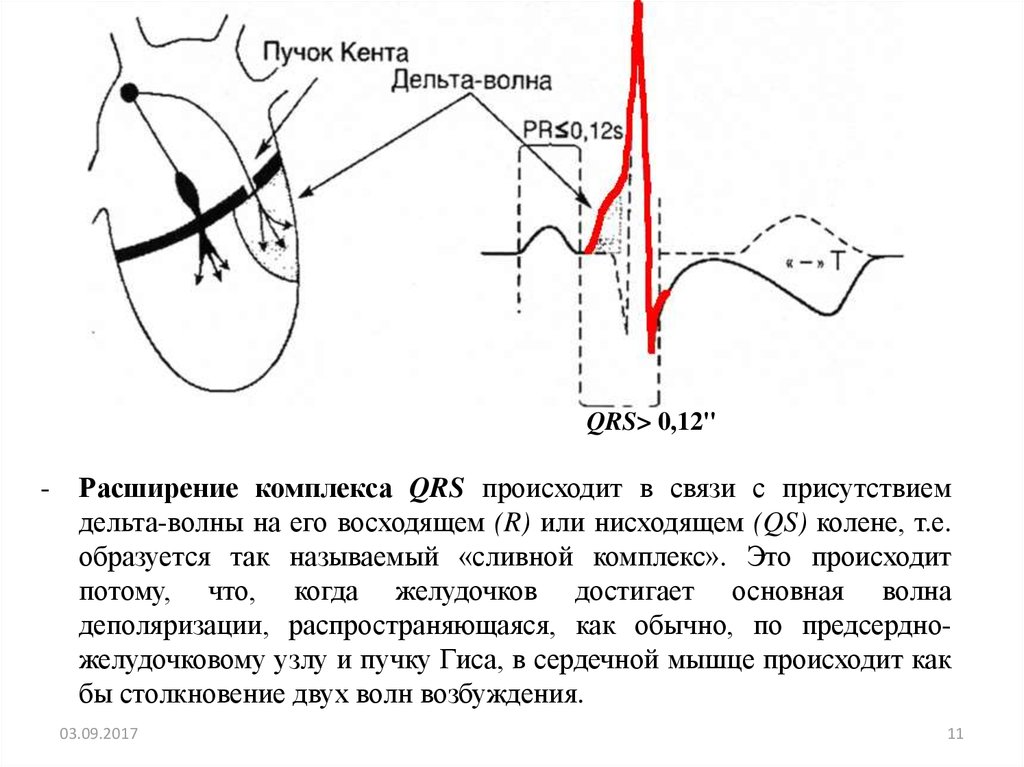 Дельта волны