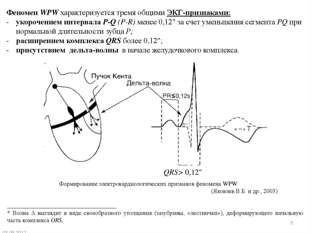 Синдром впв презентация