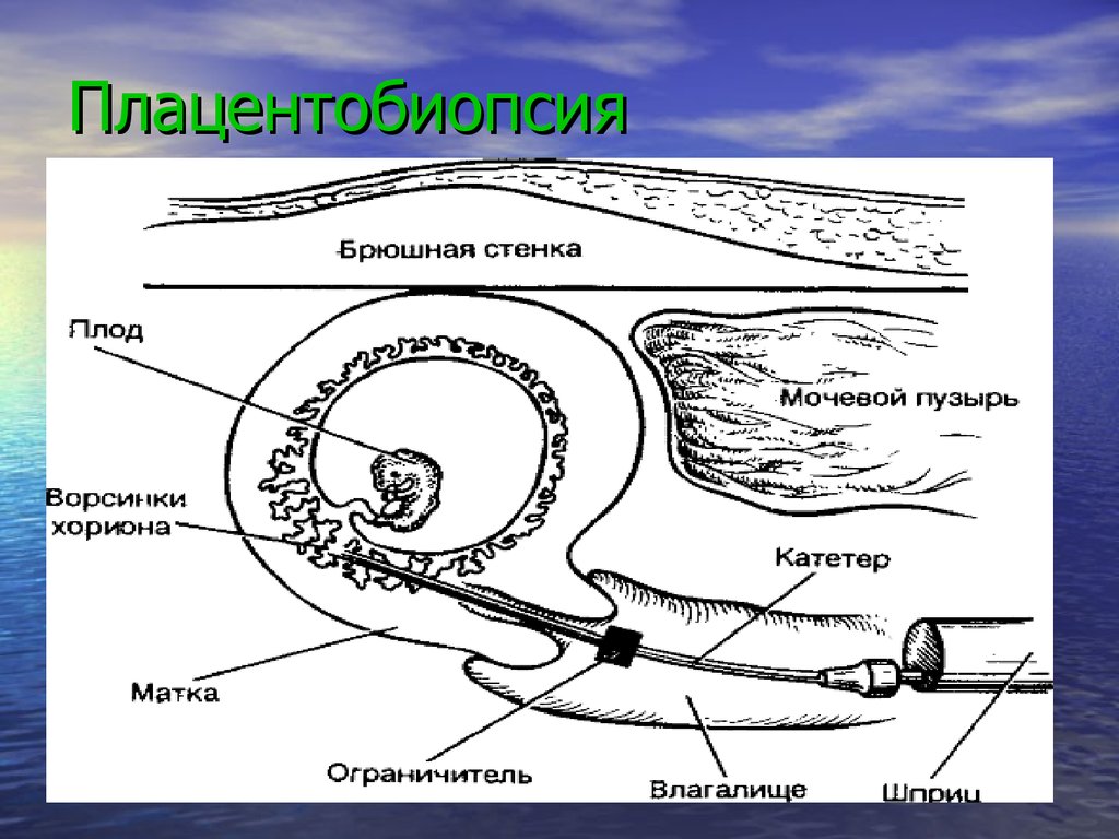 Плод и мочевой пузырь картинки