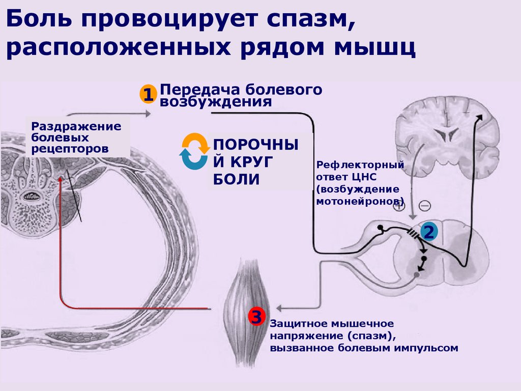 Рефлекторные боли. Механизм возникновения мышечного спазма. Спастическое сокращение мышц. Механизм возникновения мышечной боли. Механизмы спастичности мышц.