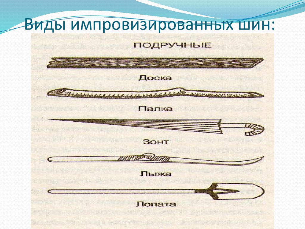 Подручные и табельные средства транспортной иммобилизации. Виды импровизированных шин. Шины стандартные и импровизированные. Импровизированные шины в медицине. Табельные шины иммобилизации.