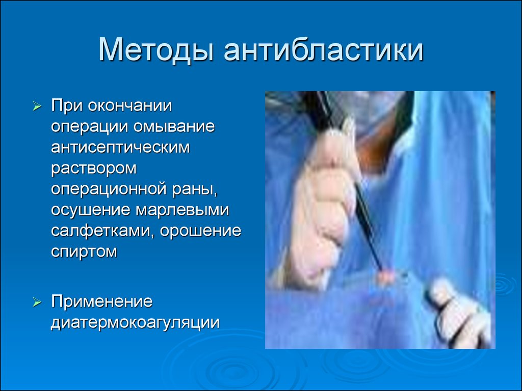 Операция окончание. Методы антибластики. Наблюдение за областью операционной раны. Абластика и антибластика в онкологии. Наблюдение за операционной раной.