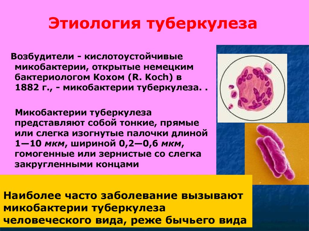 Микобактерия возбудитель. Палочка Коха возбудитель туберкулеза. Микобактерии возбудители туберкулеза. Этиология туберкулеза. Этиоэтиология туберкулеза.