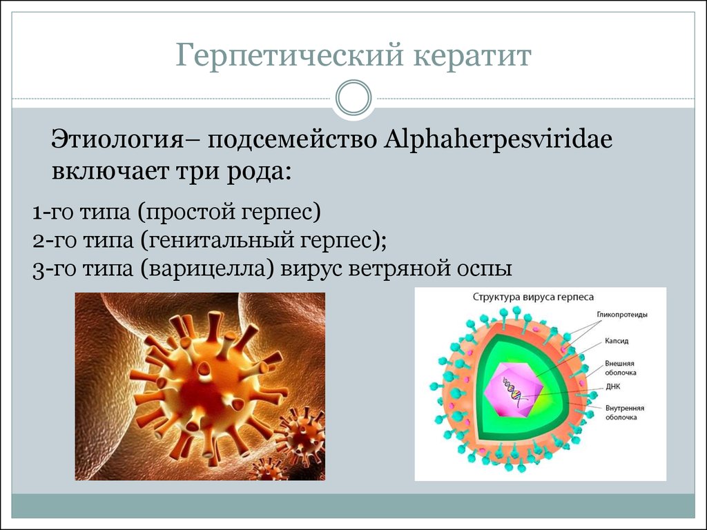 Вирус простого герпеса. Ветряная оспа вирус герпеса 3 типа. Вирусный кератит. Герпетический кератит. Вирус герпеса 1 типа этиология. Этиология вируса простого герпеса 2 типа.