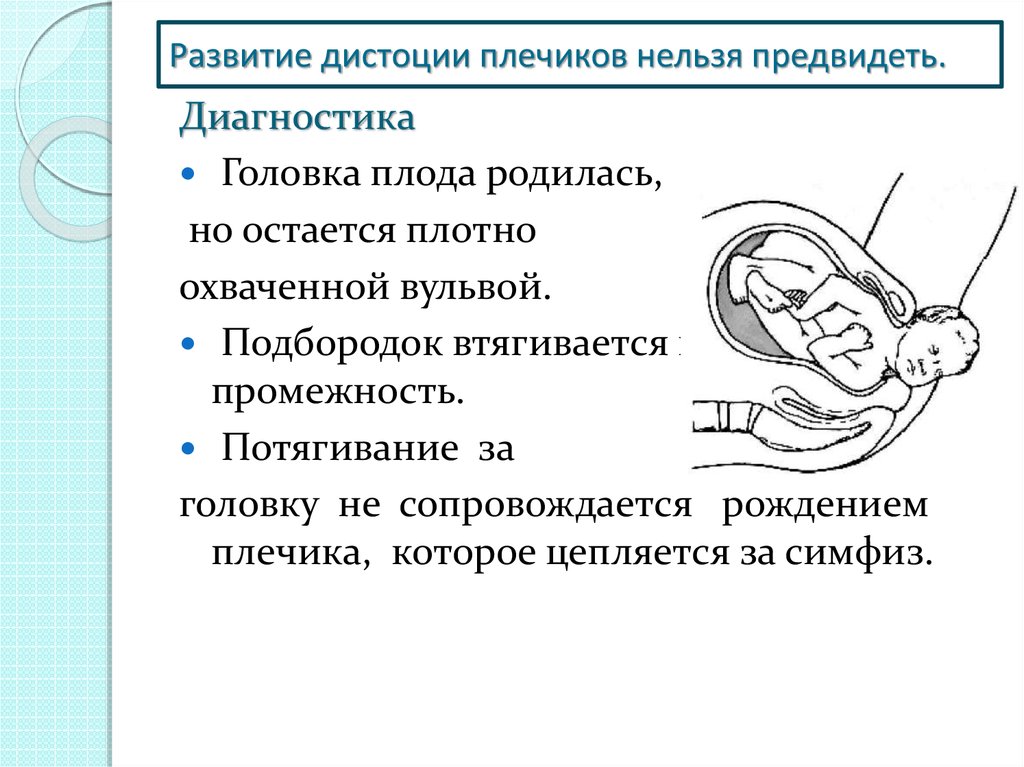 Дистоция плечиков презентация