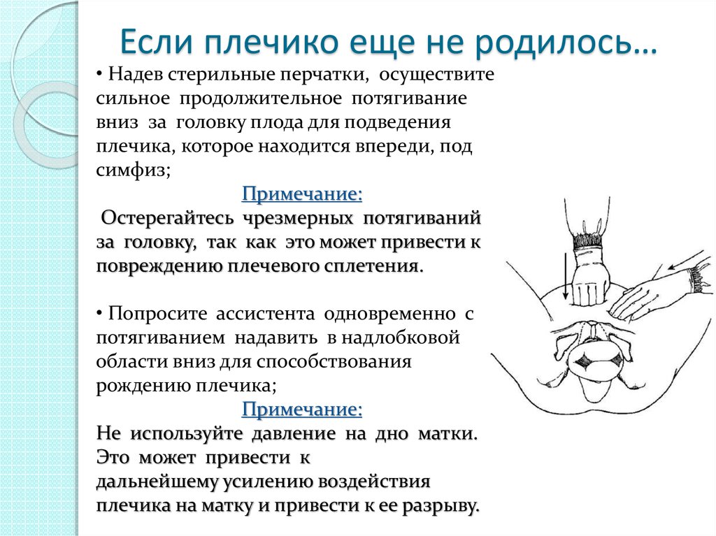 Дистоция плечиков презентация