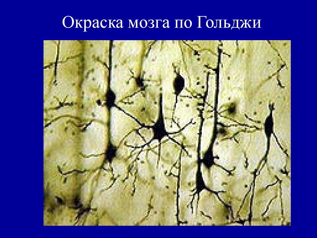 Клетки беца. Клетки Беца коры больших полушарий. Клетки Беца гистология. Окраска по методу Гольджи. Окраска нейронов по Гольджи.