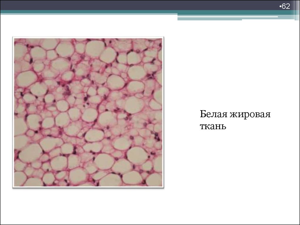 Название жировой ткани. Белая жировая ткань гистология. Белая жировая ткань гистология строение. Белая жировая ткань гистология препарат. Белая Живая ткань гистология.
