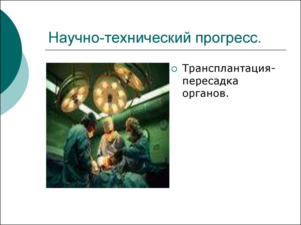 Научно технический прогресс во второй половине 20 века презентация