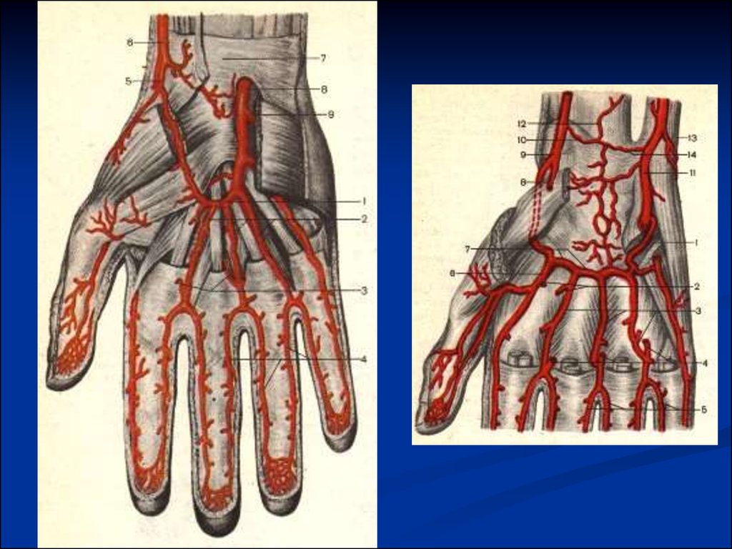 Лимфоузлы кисти. Лимфатическая система кисти. Лимфатическая система кисти руки. Лимфатические узлы на кисти руки. Лимфатическая система кисти руки человека схема.