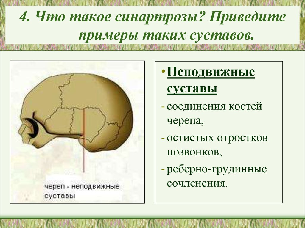 Неподвижная кость черепа. Синартроз соединение костей. Соединения черепа(синартрозы). Соединение костей черепа синхондрозы. Швы черепа синартроз.