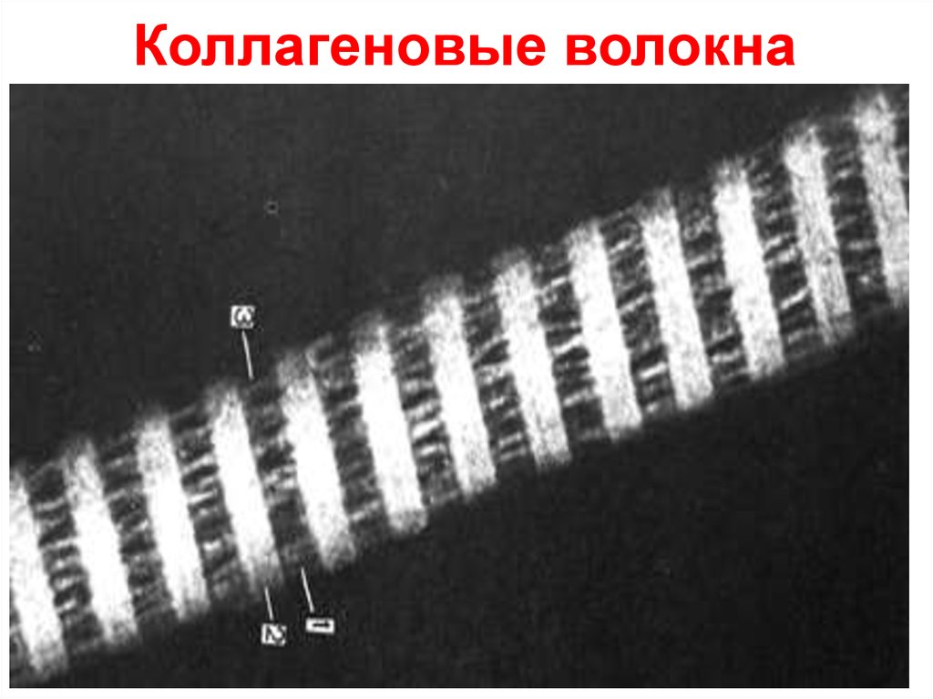 Коллагеновые волокна картинка