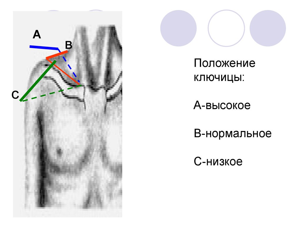 Ключица расположение