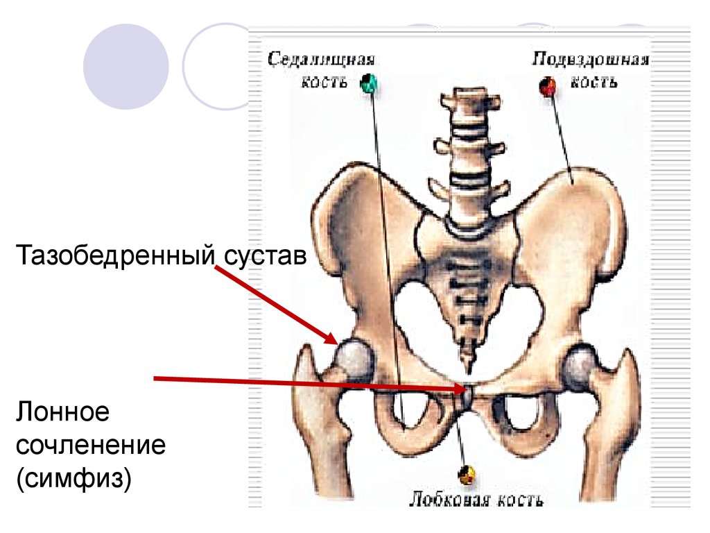 Подвздошной кости 2. Кости таза лонное сочленение. Симфизит, расхождение костей лонного сочленения. Кости лонного сочленения при беременности. Лобковый симфиз и лобковая кость.