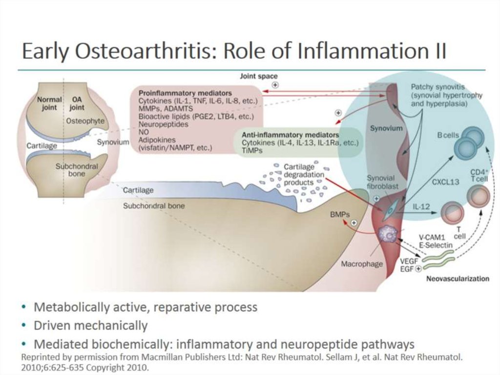 Early Osteoarthritis: Role of Inflammation II