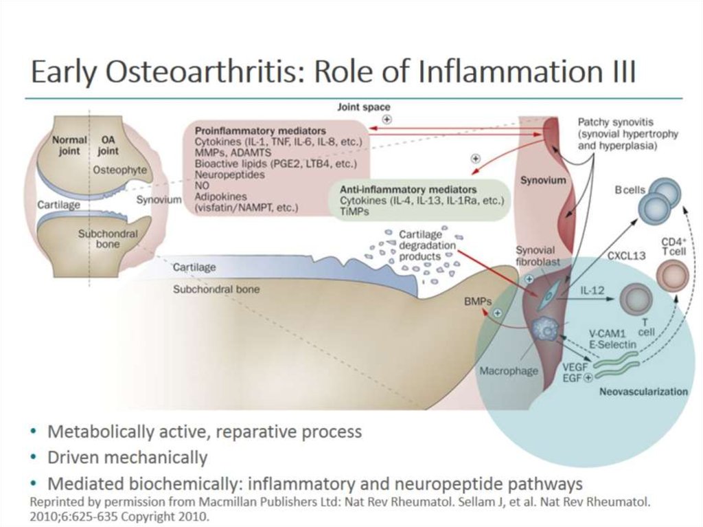 Early Osteoarthritis: Role of Inflammation III