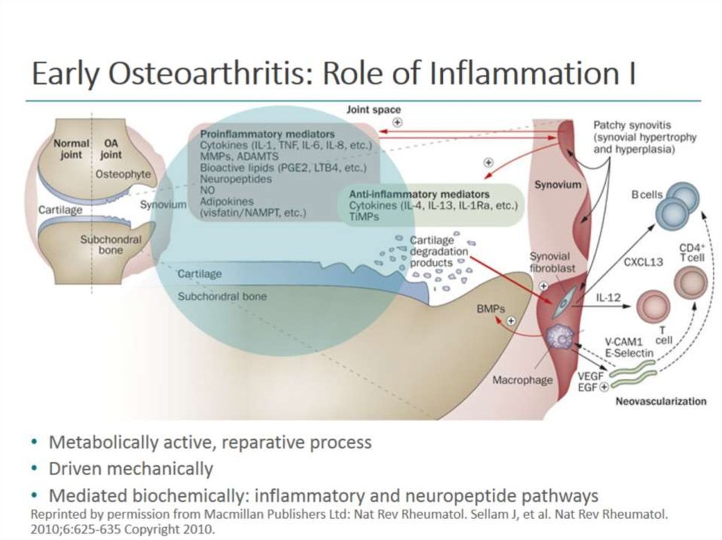 Early Osteoarthritis: Role of Inflammation I