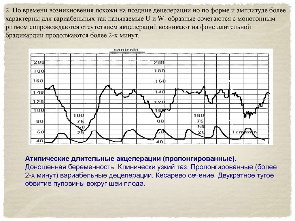 Ктг с одним датчиком