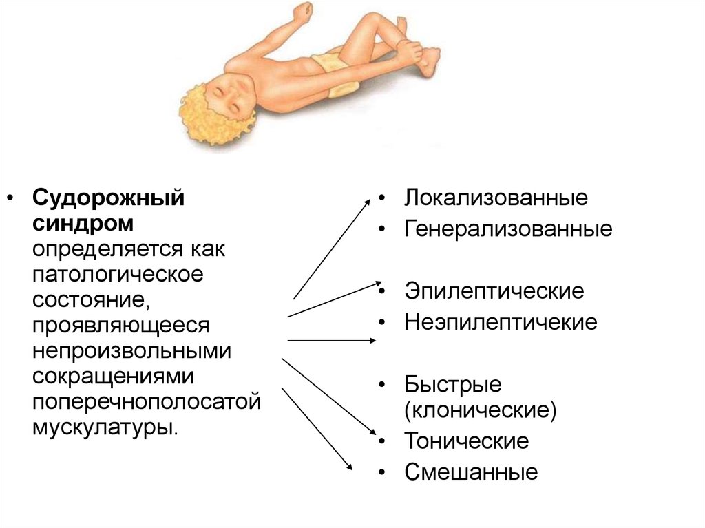 Судорожные припадки фото