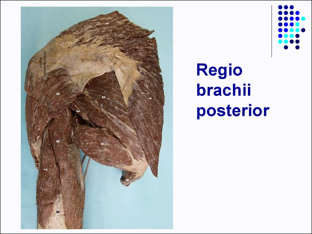 nerve upper suprascapular regio brachii limb posterior ppt