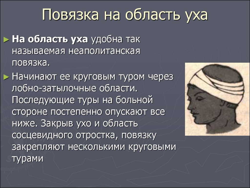 Повязка алгоритм. Неаполитанская повязка. Наложение повязки на ухо. Неаполитанская повязка на голову. Неаполитанская повязка на область уха.