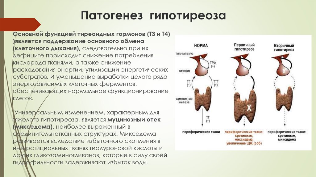 Схема механизмов развития висцеропатической стадии тиреотоксикоза