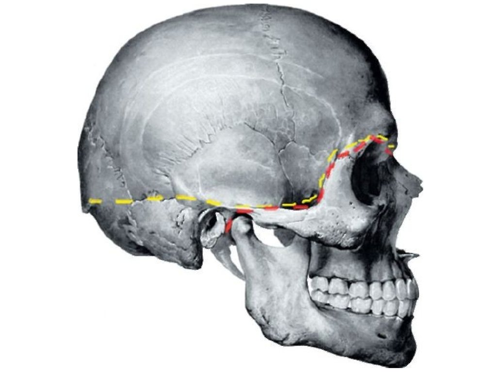 Мозговое основание черепа. Граница мозгового и лицевого отделов черепа. Граница между мозговым и лицевым отделом черепа. Граница между сводом и основанием черепа. Свод и основание черепа.