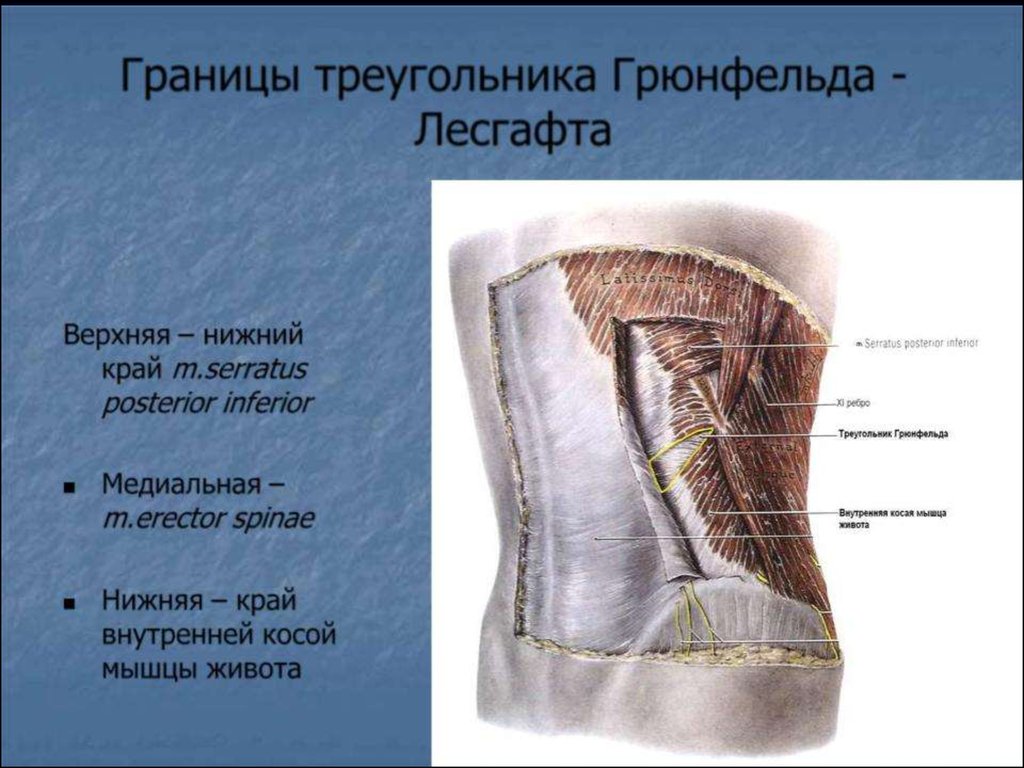 Укажите верхнюю. Поясничный четырехугольник Грюнфельда-Лесгафта. Треугольник Лесгафта-Грюнфельда Пти. Треугольник Лесгафта Грюнфельда границы. Четырехугольник Лесгафта-Грюнфельда границы.