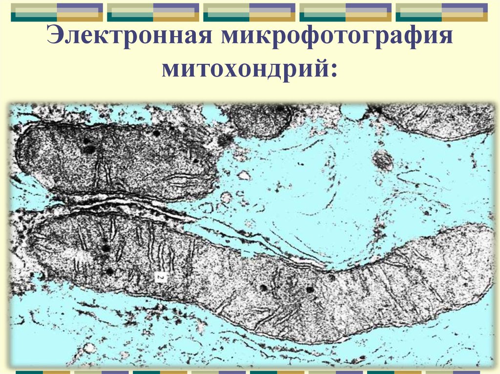 Какова функция органоида электронная микрофотография которого представлена на рисунке