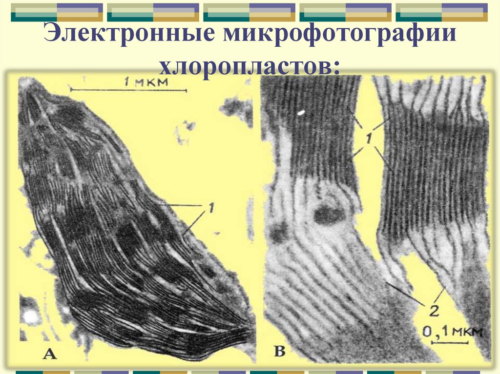 Увеличение клеток. Электронная микрофотография. Электронная микрофотография хлоропласта. Пластиды микрофотография. Пропластиды электронная микрофотография хлоропластов.