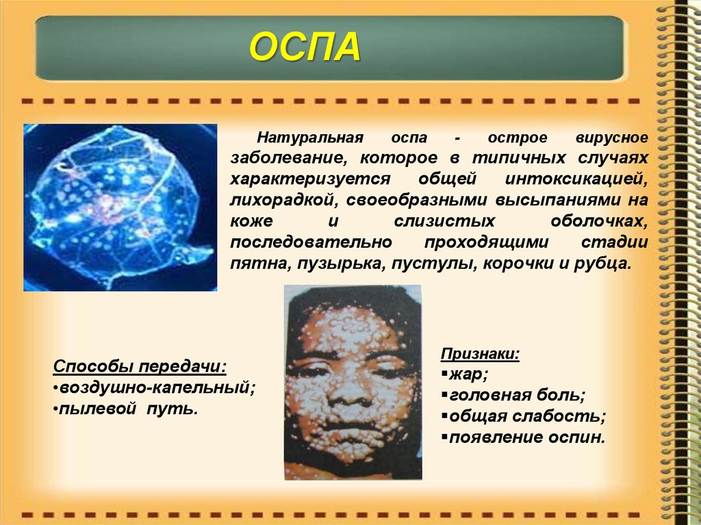 Оспа методы профилактики. Вирус натуральной оспы симптомы. Натуральная оспа симптомы. Натуральная оспа болезнь.