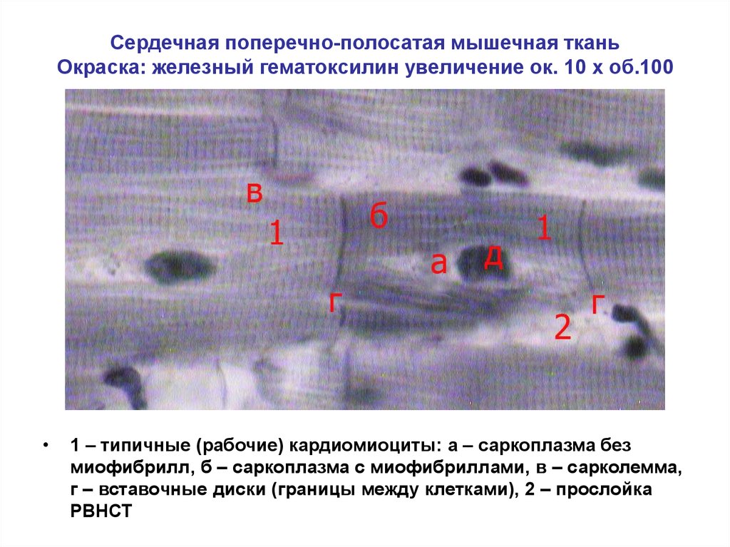 Сердечно поперечная ткань. Сердечная мышечная ткань окраска Железный гематоксилин. Сердечная мышечная ткань препарат окраска Железный гематоксилин. Сердечная мышечная ткань гистология окраска железным гематоксилином. Сердечная мышечная ткань Железный гематоксилин препарат.