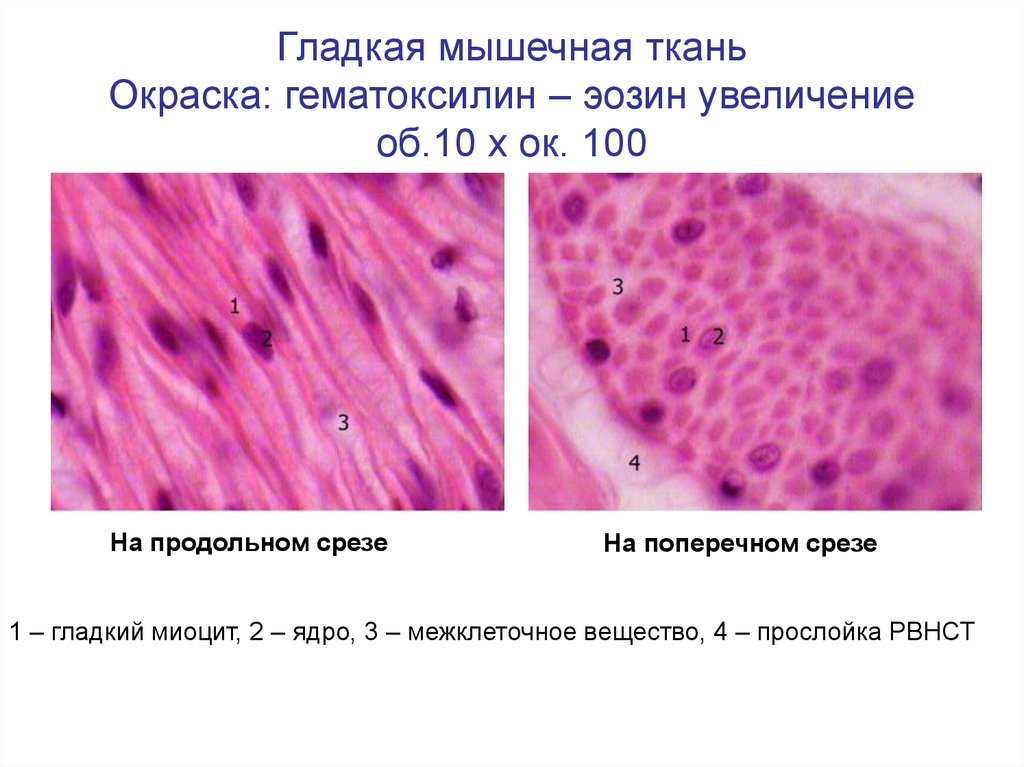 Гладкая мышечная ткань рисунок с подписями