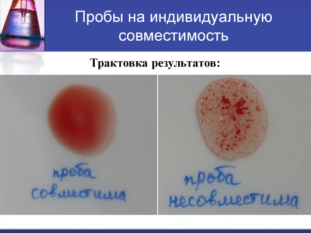 Проба на совместимость. Проба на индивидуальную совместимость. Проба на совместимость крови. Проба на индивидуальную совместимость крови. Проба на совместимость крови донора и реципиента.