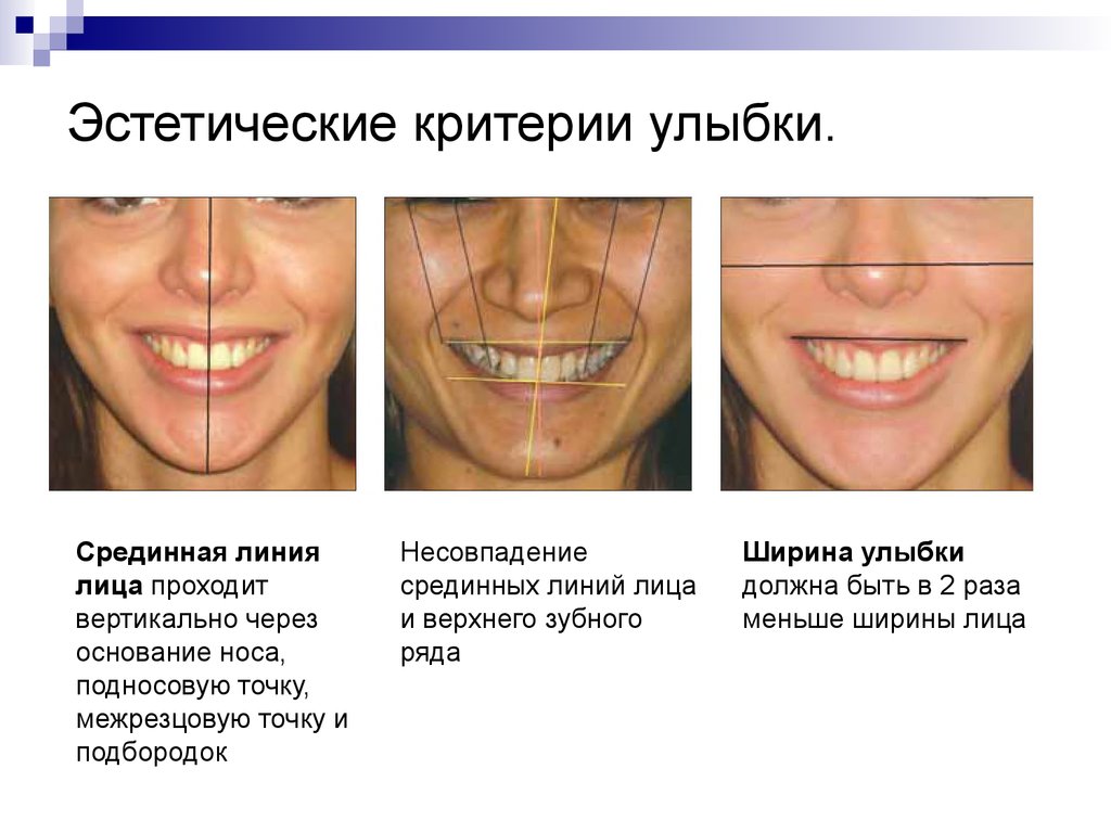 Эстетские реакции что это. Понятие эстетики в стоматологии. Эстетические критерии улыбки. Срединная линия лица. Типы линии улыбки.